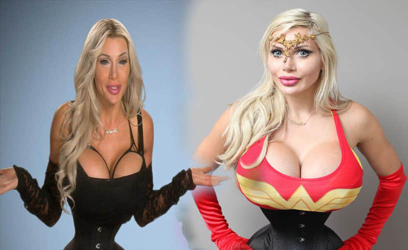 Model who has undergone more than 100 cosmetic procedures