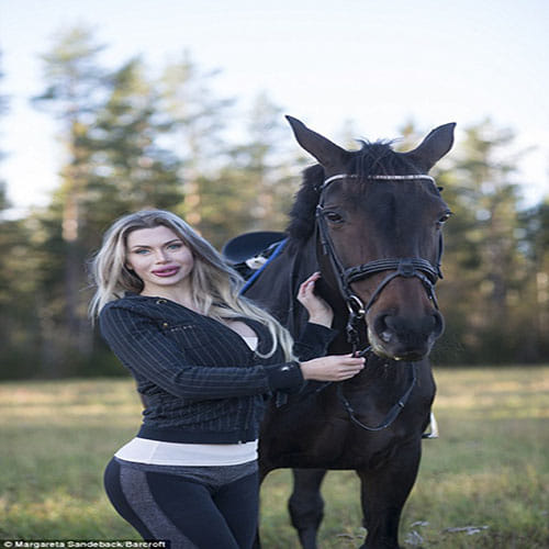 Model who has undergone more than 100 cosmetic procedures