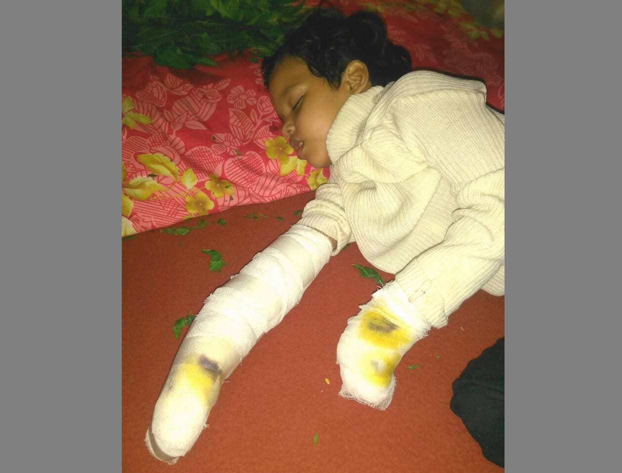 high voltage transmission lines broke on child.