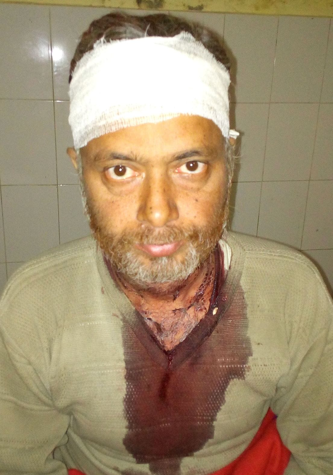 Mustafa took home the wounded brother Javed