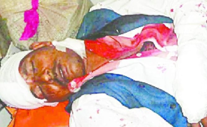 The two sides went in tablets, the young man's death