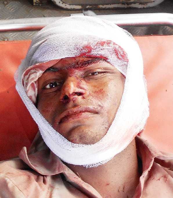 injured in tiger attack