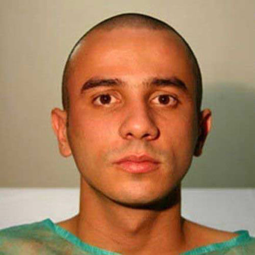 Brazilian Man Got a Dog Face by Plastic Surgery