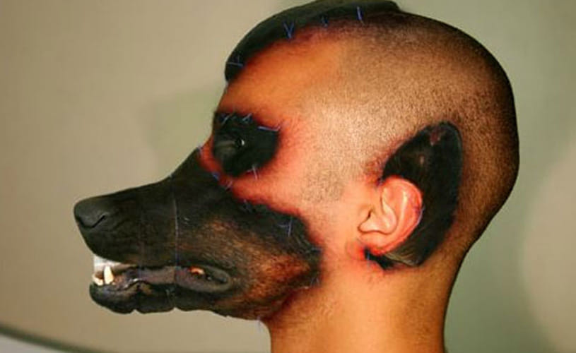 Brazilian Man Got a Dog Face by Plastic Surgery