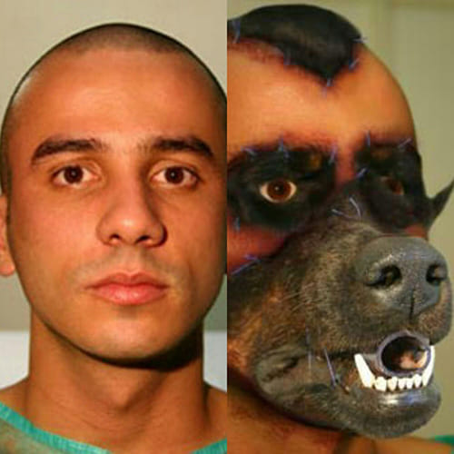 Brazilian Man Got a Dog Face by Plastic Surgery