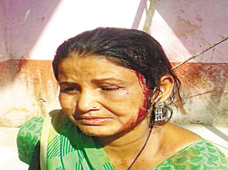 Blamed the electricity meter installation