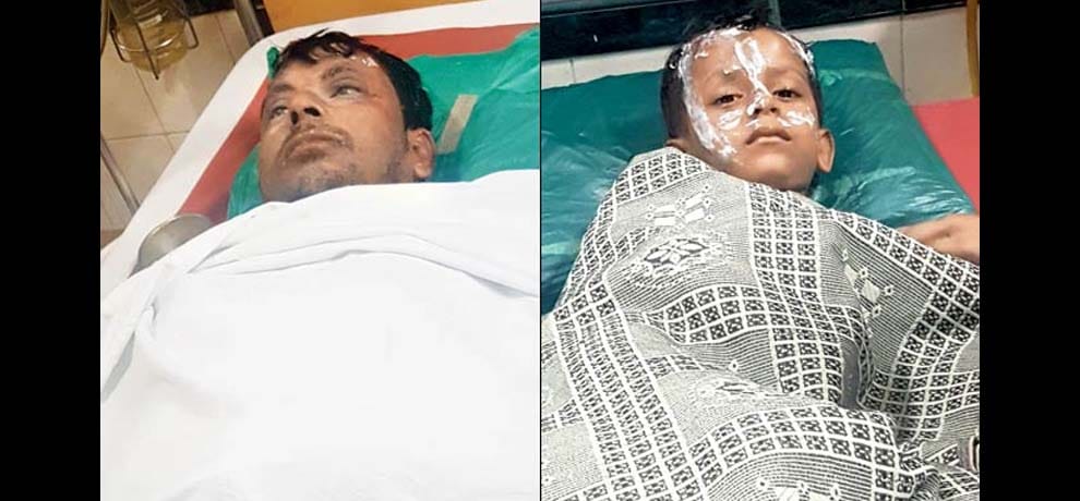 acid threw on family when they were sleeping in mumbai