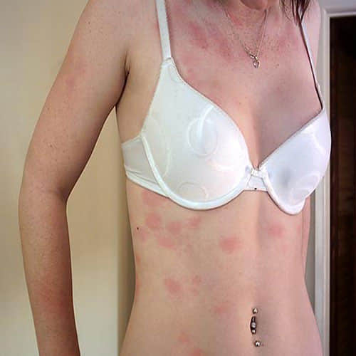  This australian girl is allergic to water