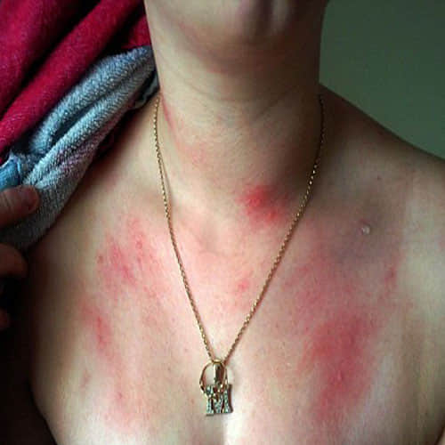  This australian girl is allergic to water