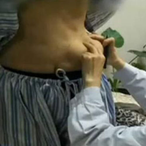 Woman grows breasts on her belly