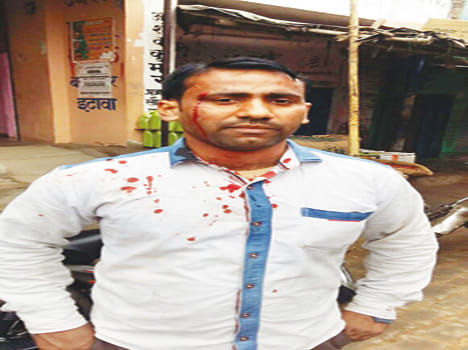 poorwanchal bank worker beaten