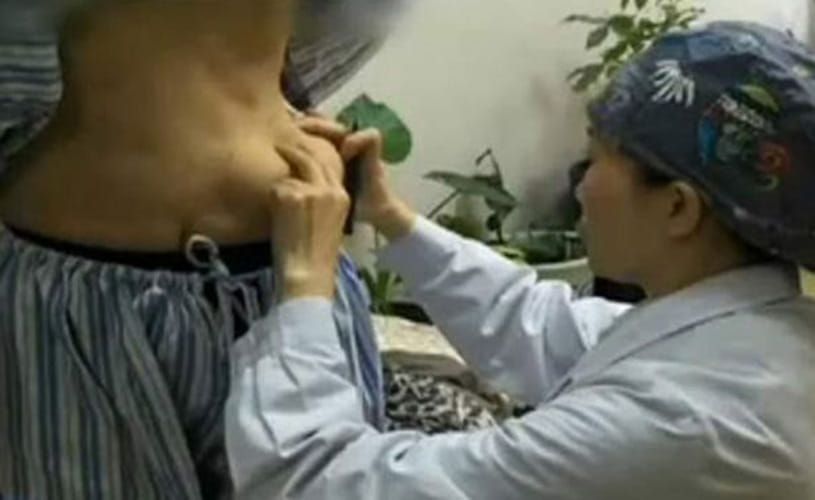 Woman grows breasts on her belly
