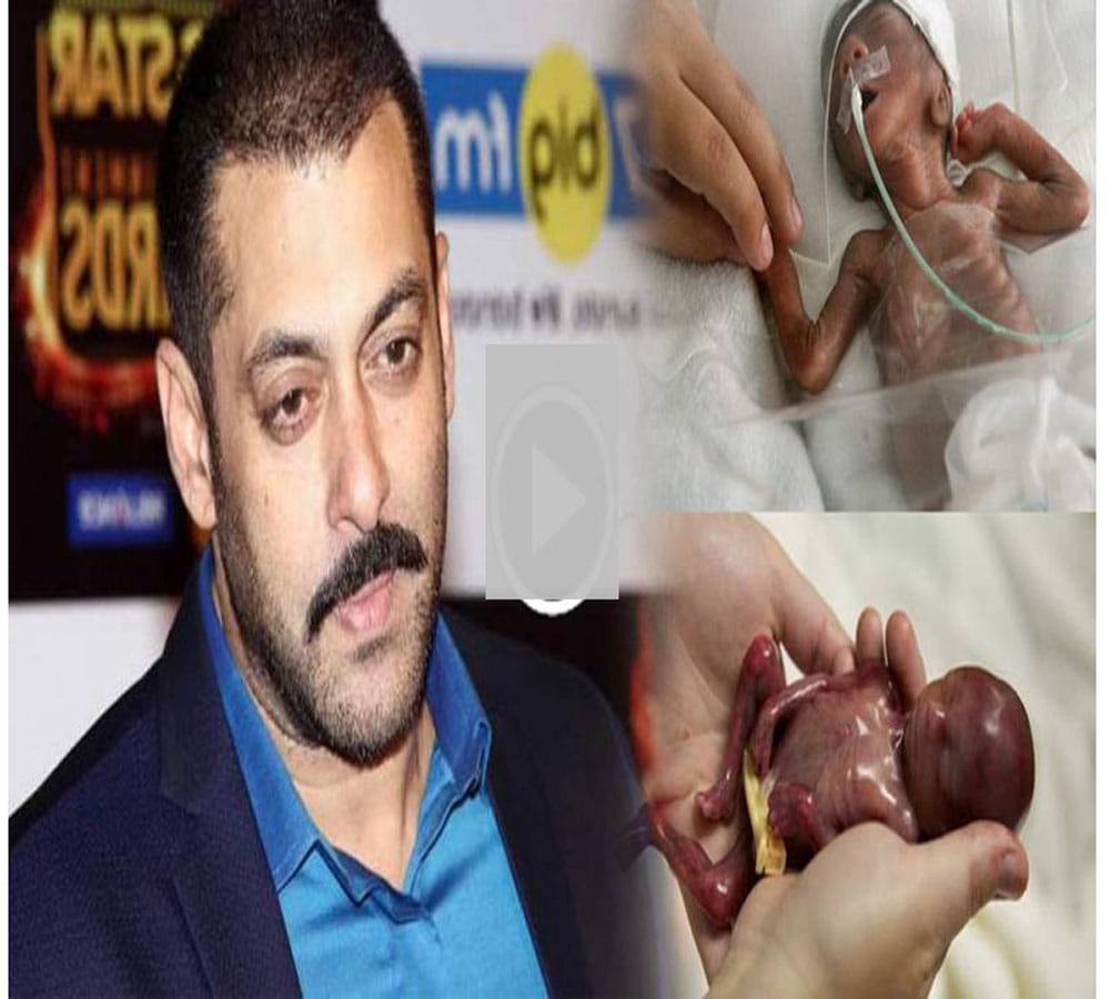 salman khan help to 5 month old pre mature baby