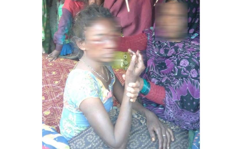  brother attacked on sister and injured her very badly in UP