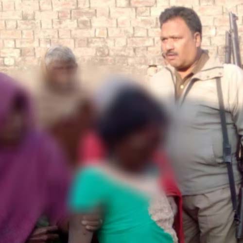  brother attacked on sister and injured her very badly in UP