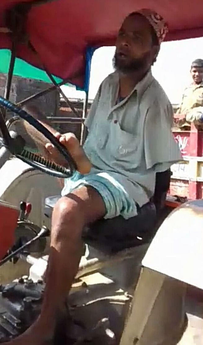 Lost a hand in the accident, feet run shop