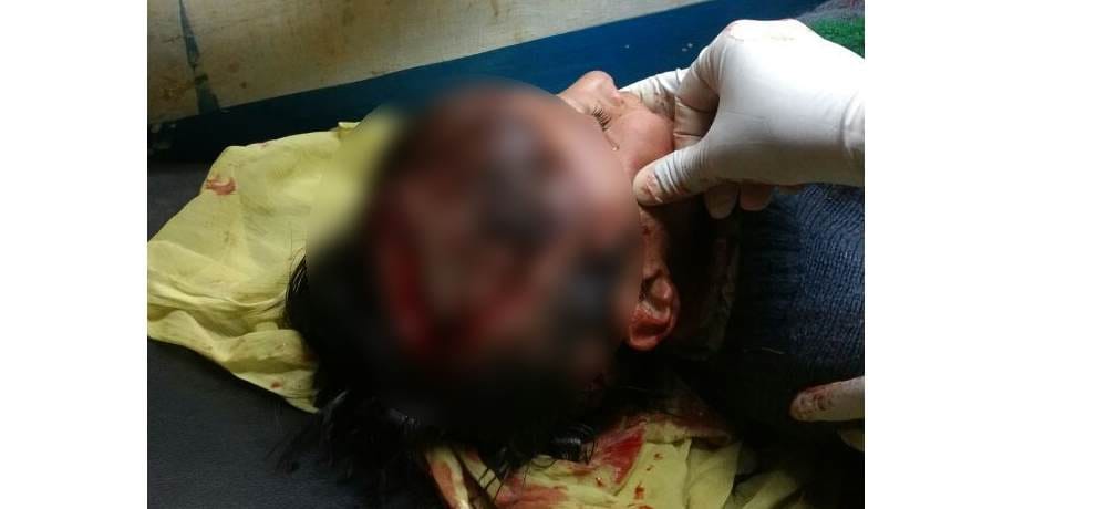 Girl injured in bear attack at school in chamba bharmour