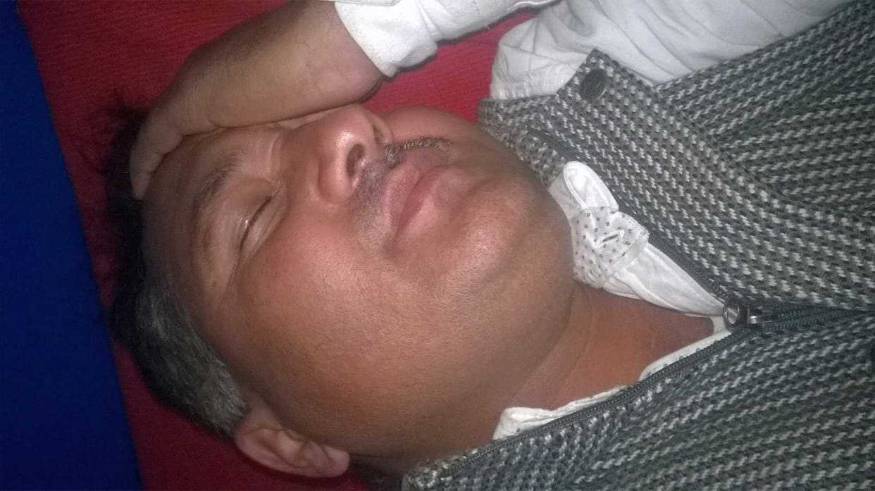 bjp leader and coongress worker fight cingress worker 