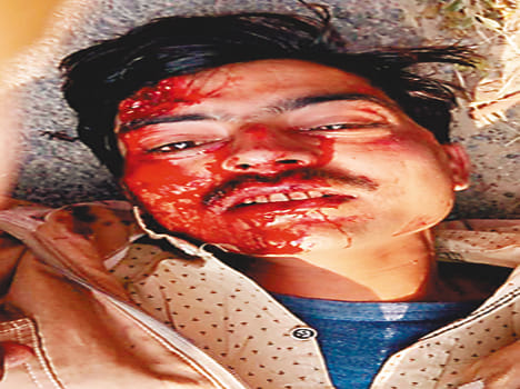 Two people injured in road accidents
