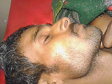 Father-in-law was hurt by beating drank Dye