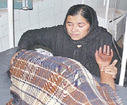pita ne beti par tezab dala