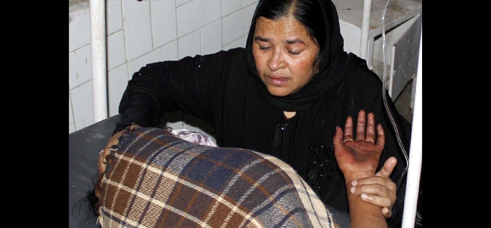 father threw acid on daughter in UP Bijnor