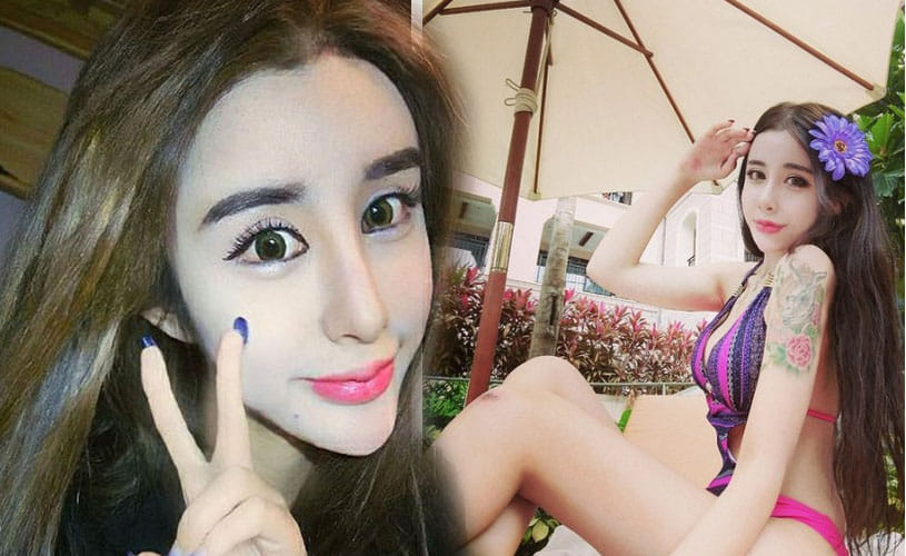 15-Year-Old Girl Gets Extreme Plastic Surgery