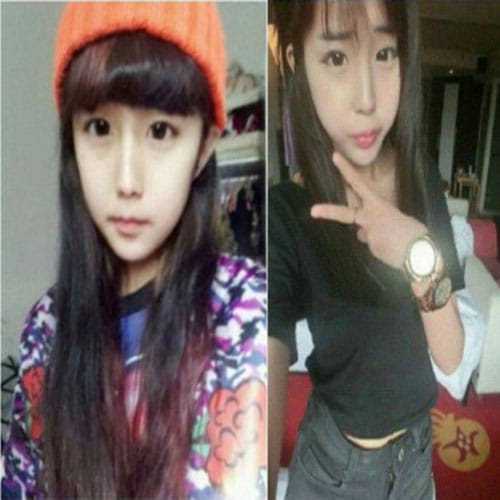 15-Year-Old Girl Gets Extreme Plastic Surgery