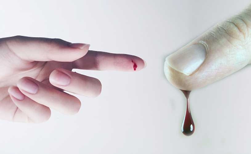Home Remedies To Stop Bleeding easily