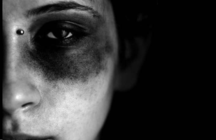 husband beaten wife many times for dowry in UP