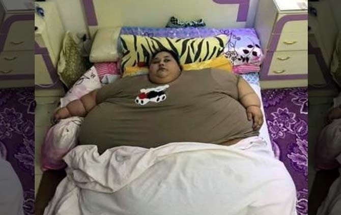 foreign minister sushma swaraj will try to help world fattest women