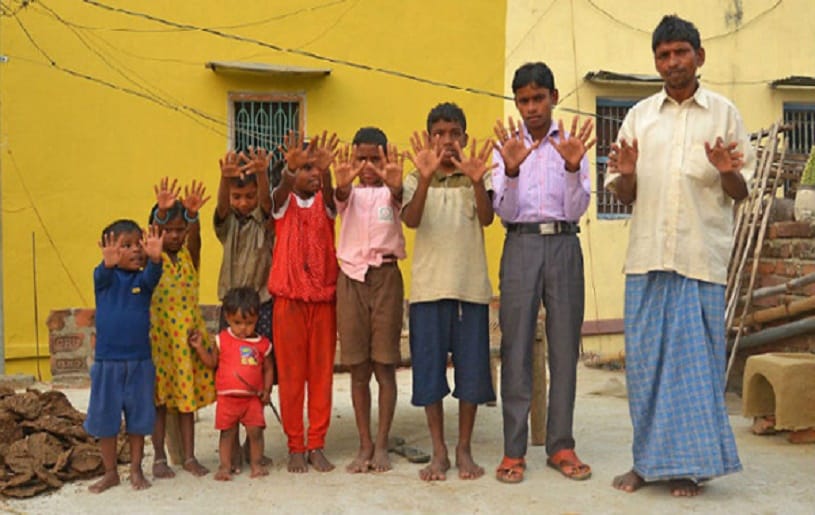 members of a family have 24 fingers