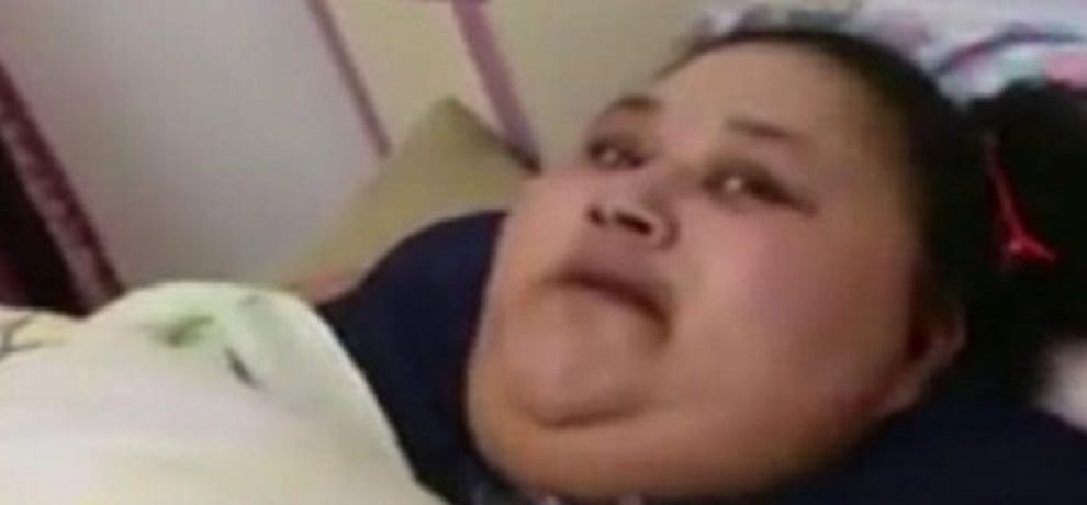 gurgaon doctors find that a gene is responsible for fatness of worlds heaviest woman eman ahmad