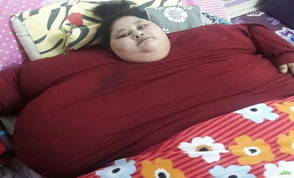 World Heaviest Woman Eman Ahmed Dies Today In Abu Dhabi Amar Ujala Hindi News Live एमन की 