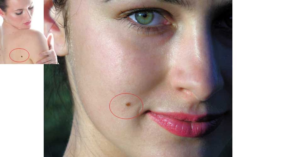 mole on these body parts is lucky for you