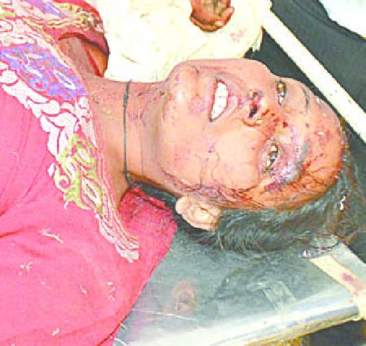 Family attacked, three injured