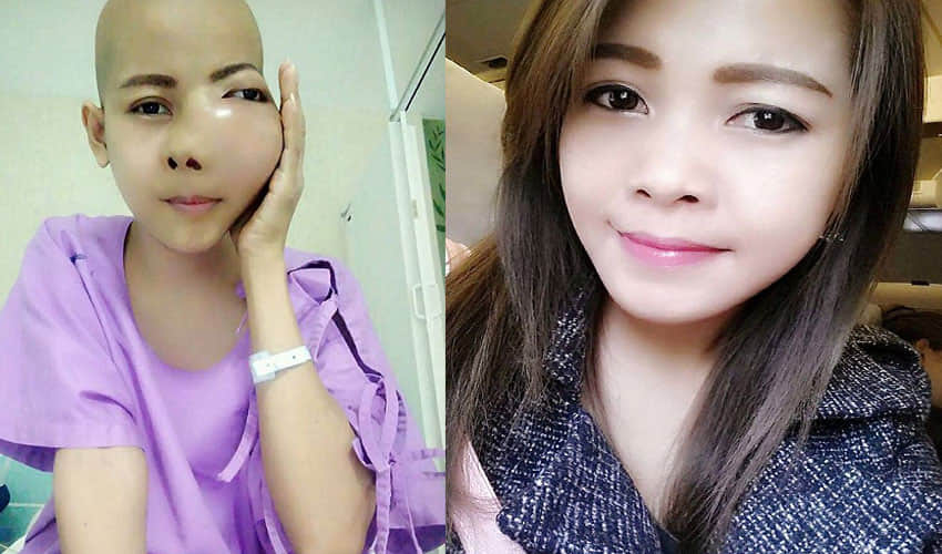 women was shocked after discovering cancer while visiting dentist