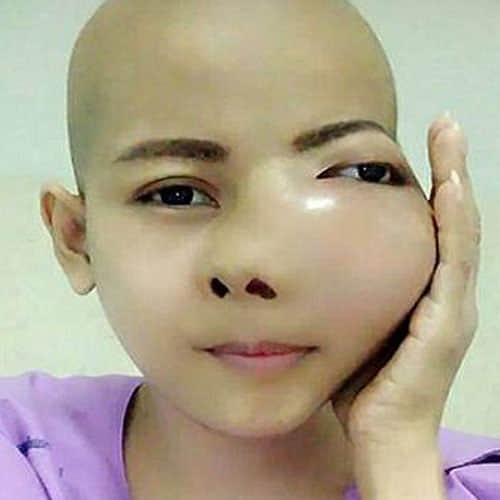 women was shocked after discovering cancer while visiting dentist