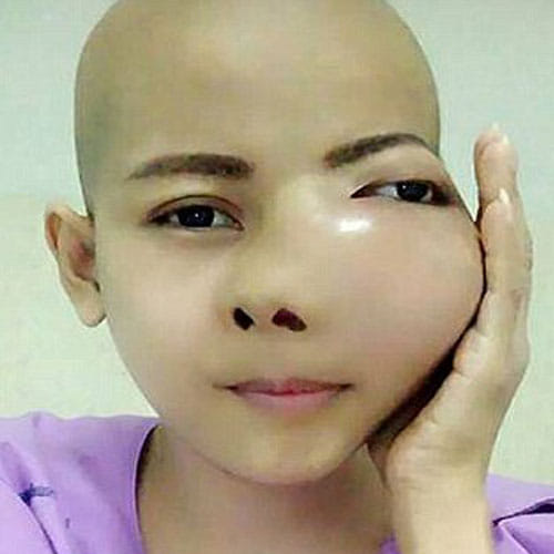 women was shocked after discovering cancer while visiting dentist