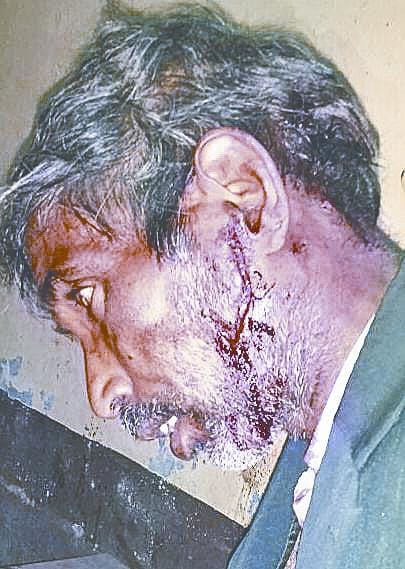 Attack of Leopard in Bhitirawat, 10 injured