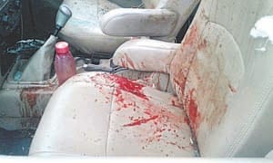 shot dead person in kunda