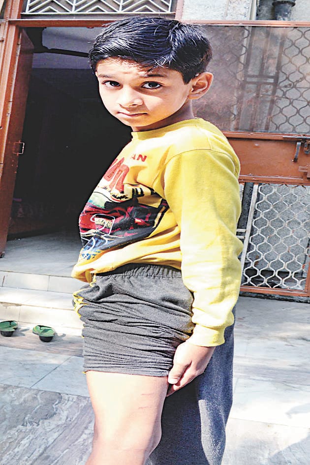 Dogs attack on two children and a young man