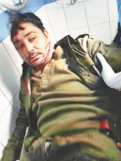 People in panic attack on police