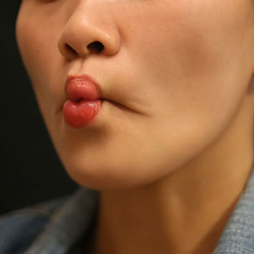Exercises For Facial Fat