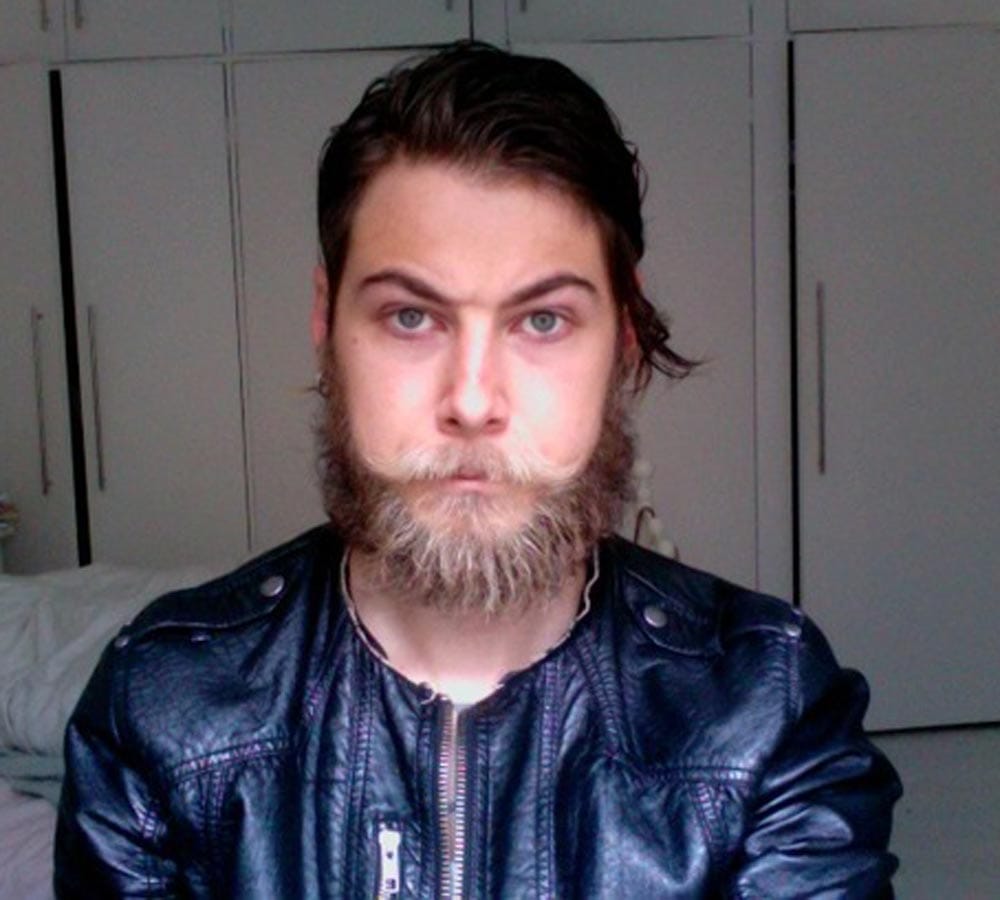 remove white hairs from beard naturally