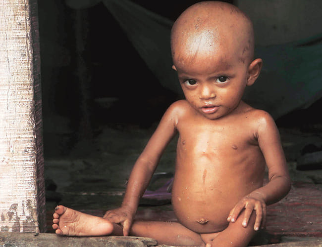  Statistics 'mirror' weak showing in childhood