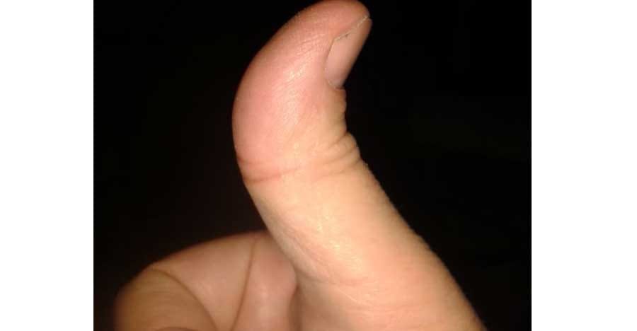 according to palmistry shastra thumb tells us nature and future