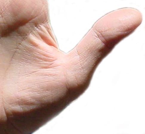 Mark on thumb tell lots of things