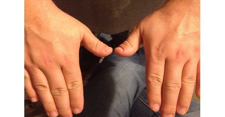 Mark on thumb tell lots of things