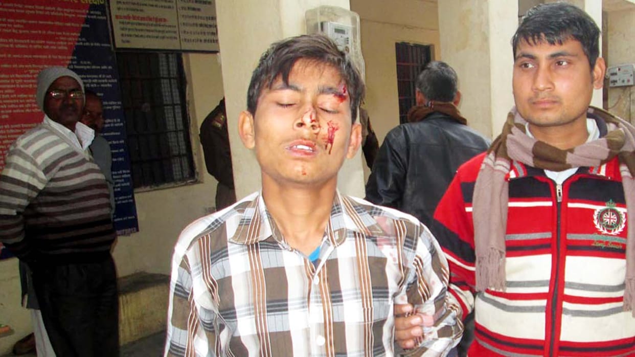 Student at school have bled